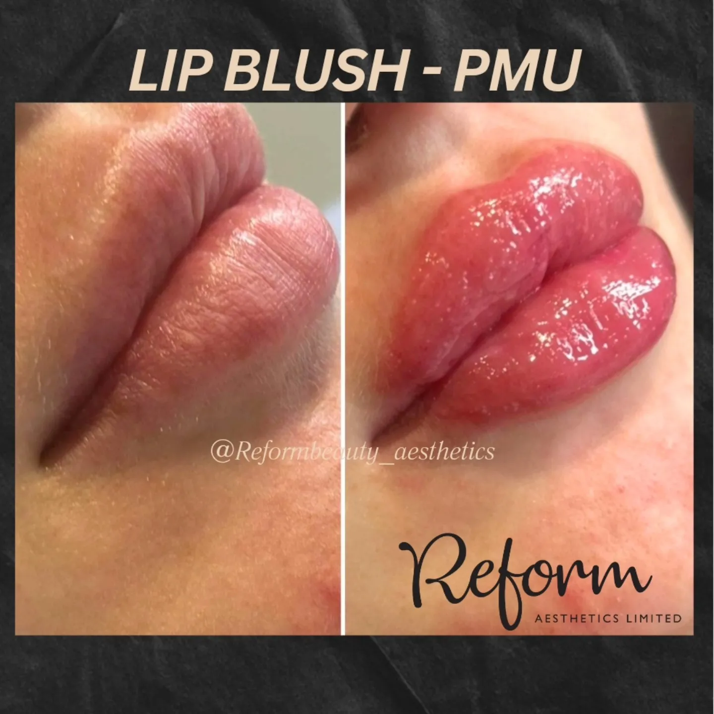 A woman's lips before and after using lip brush pmu.